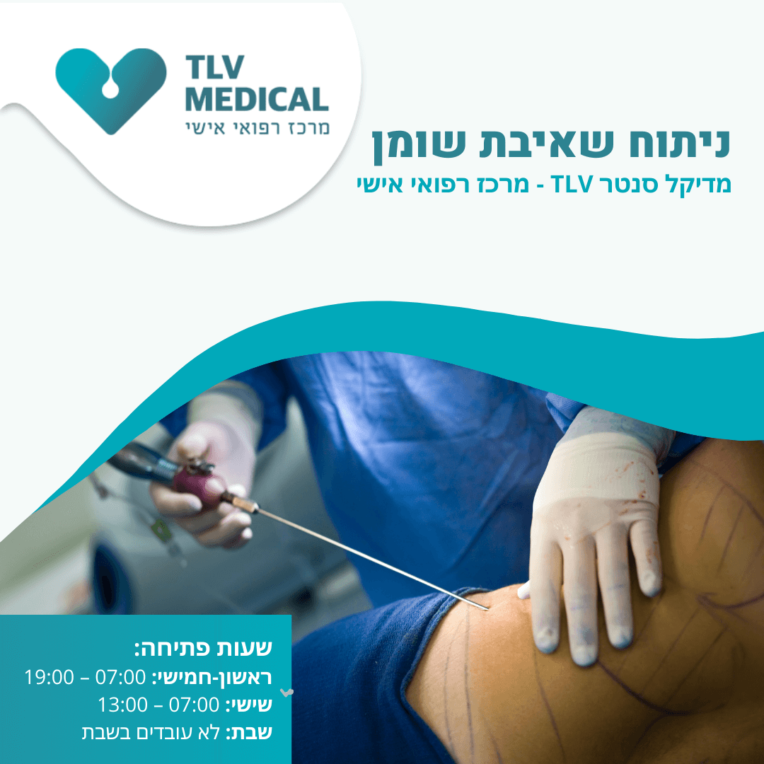 ניתוח שאיבת שומן