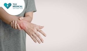 דלקת בשורש כף היד