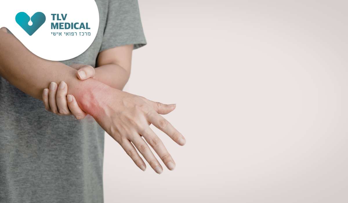 דלקת בשורש כף היד