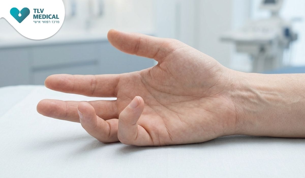 מהי מחלת דופיטרן ואיך היא משפיעה על כף היד