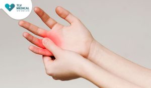 מתי עולה צורך בניתוח עצב בכף היד?